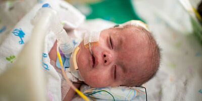 Unser Intensivpflegedienst bietet Heimdialyse an